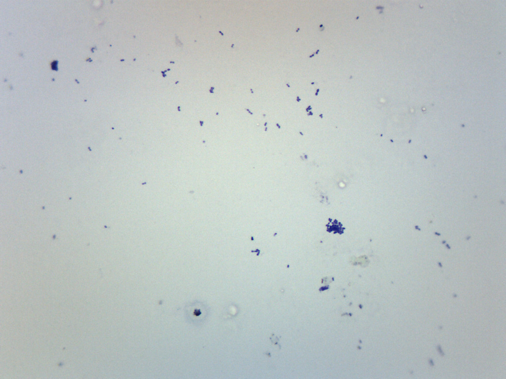Mikroskoppreparat, Streptokocker - Bild 2