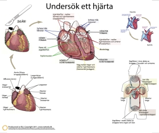 Dissekeringsduk, hjärta